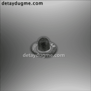 Göbekli Perçin 1815